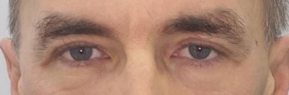 глаза мужчины